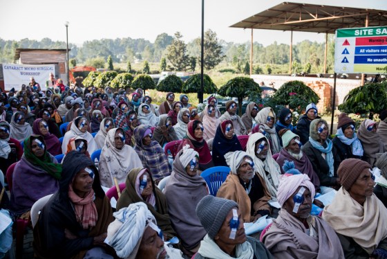 the day after the first surgeries, the patients receive instructions on post-op eye care