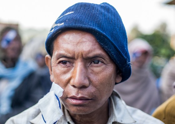 this man had been blind for more than 10 years...