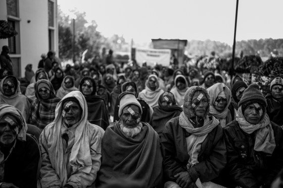 The patients did very well and this was repeated for three days resulting in 400 successful surgeries 