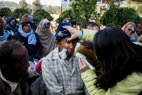 opening the eye patches, some of the patients were able to see well for the first time in years..